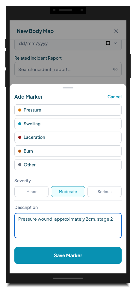 The Add Marker bottom sheet showing the marker type options (Wound, Bruise, Rash, Pressure, Swelling, Laceration, Burn, Other), Severity selector (Minor, Moderate, Serious), and Description text input with "Pressure wound, approximately 2cm, stage 2" entered. The Save Marker button is active.