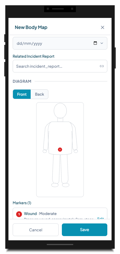 The body map form field with Front/Back toggle and human silhouette. The diagram shows a numbered marker on the abdomen with a "Wound · Moderate" annotation below.